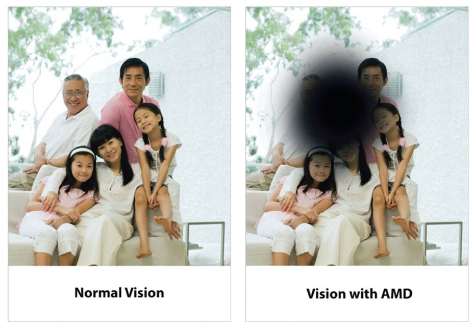 AMD vision 2